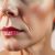 Objawy skórne menopauzy – zmiany, problemy i metody leczenia